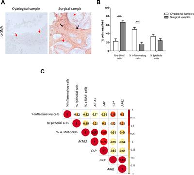 Targeted transcriptomic analysis of pancreatic adenocarcinoma in EUS-FNA samples by NanoString technology